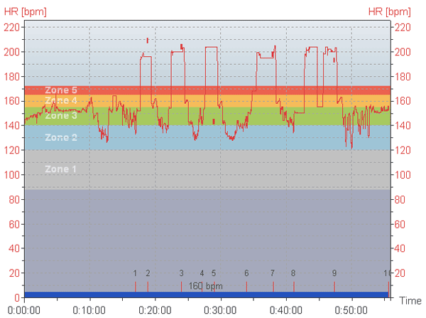 Heart rate of Mike Muha doing cross country ski intervals while experiencing Atrial Fibrillation