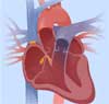 Feature image for Today, I'm having my heart shocked